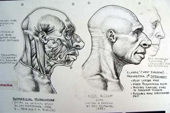 Anatomical restoration of skull